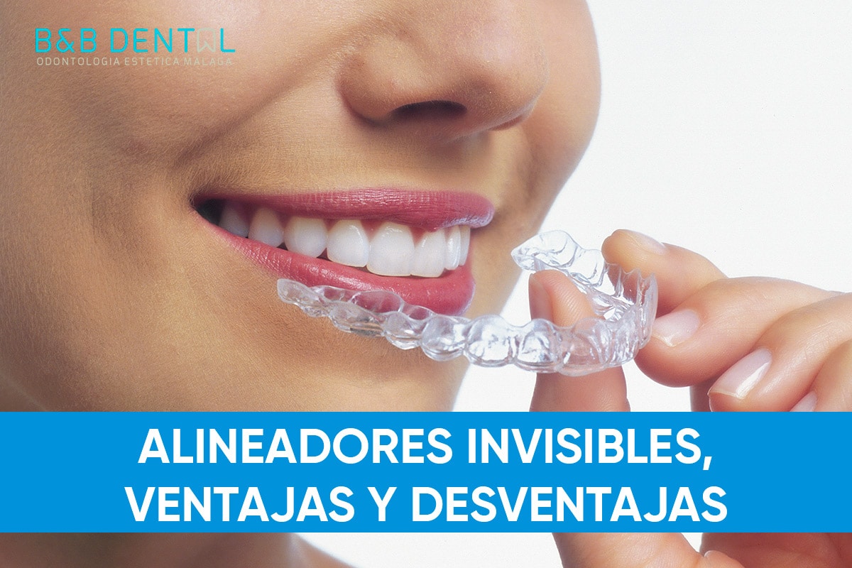 alineadores invisibles Blog