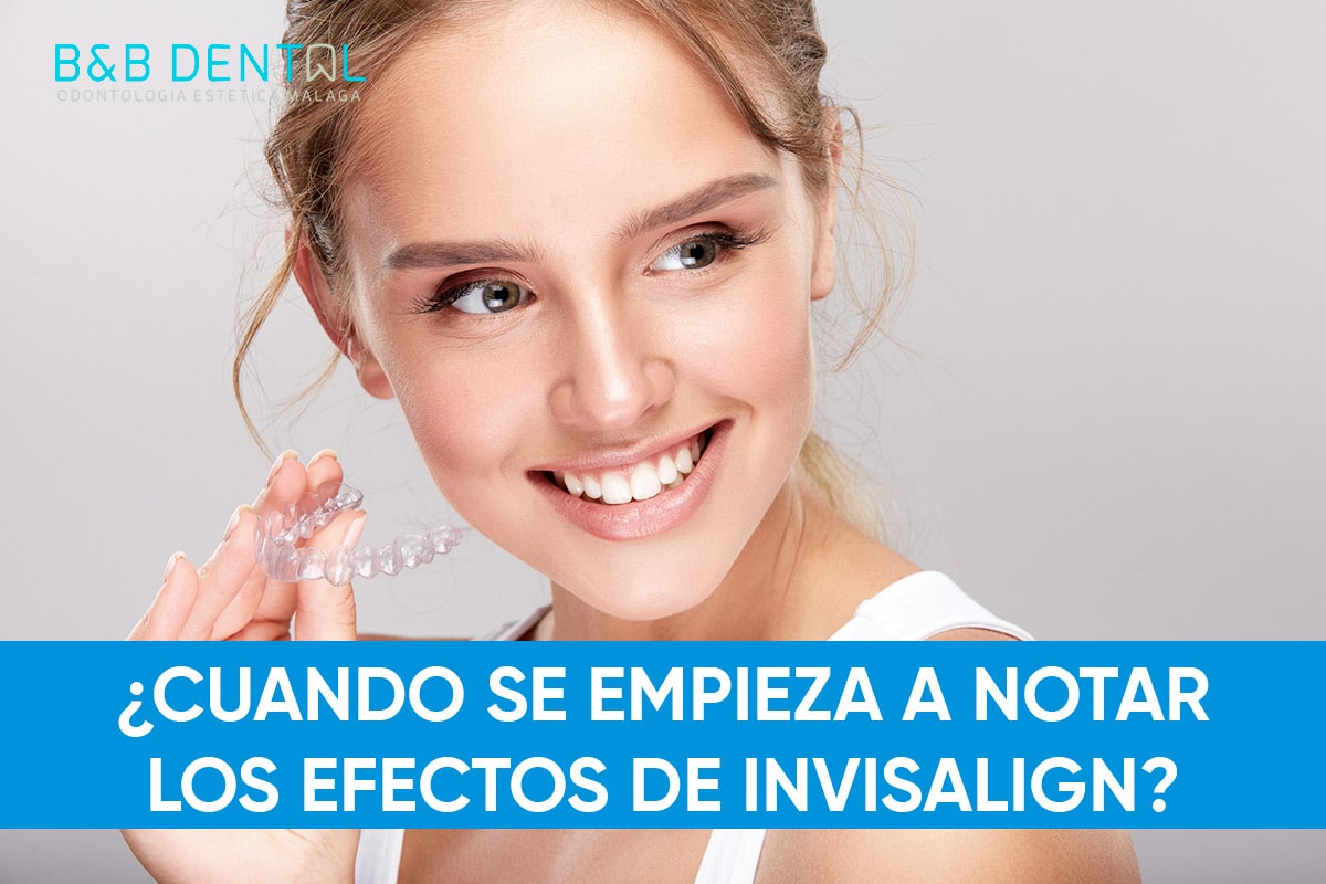 cuando se empieza a notar los efectos invisalign Blog