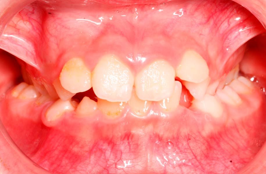 Paediatric Dentist Malaga
