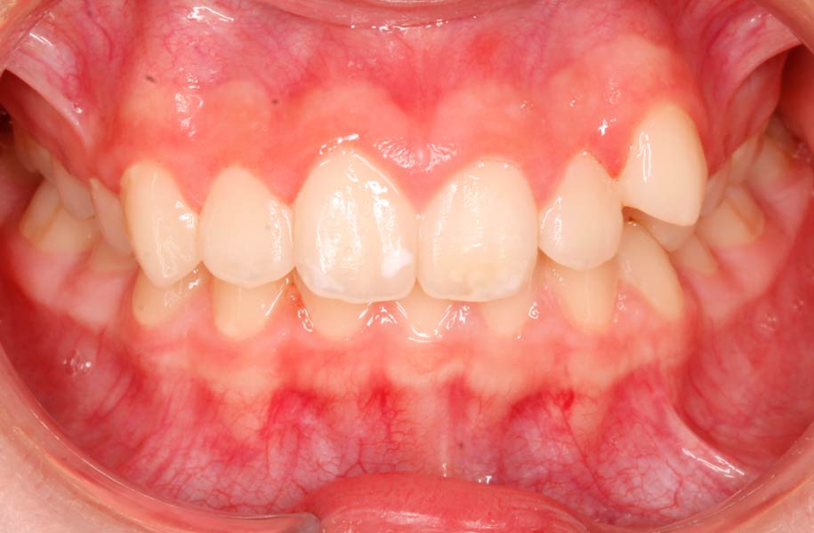 Paediatric Dentist Malaga