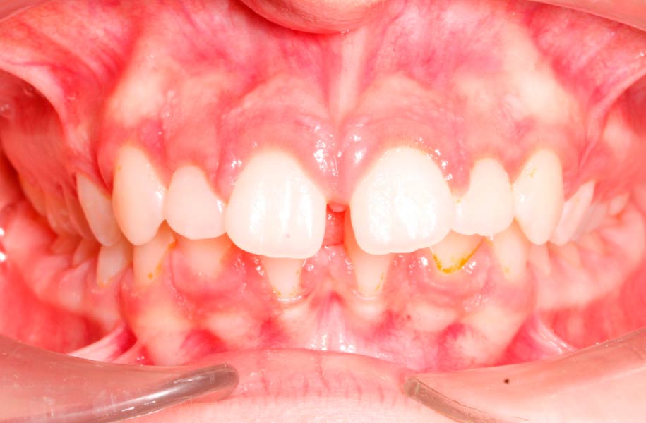 Paediatric Dentist Malaga