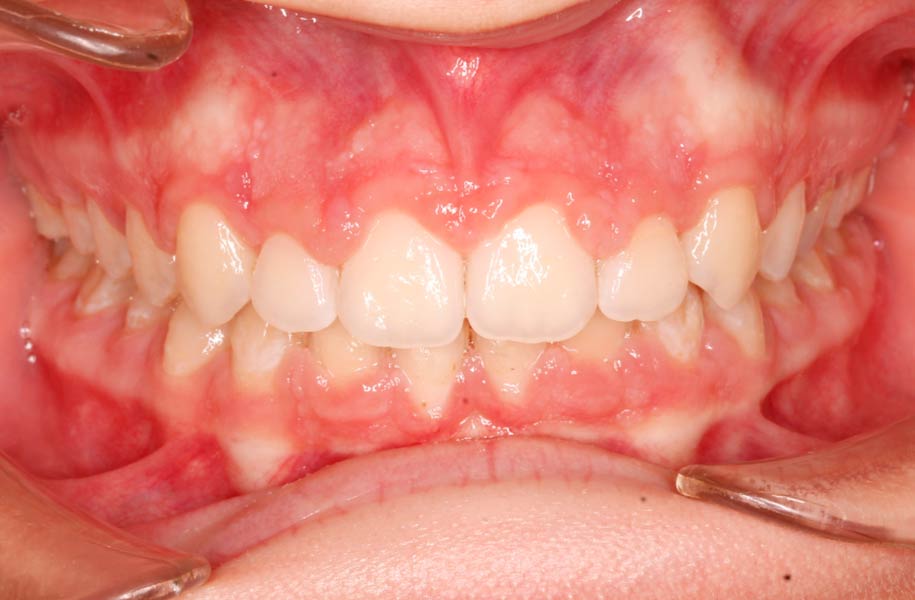Paediatric Dentist Malaga