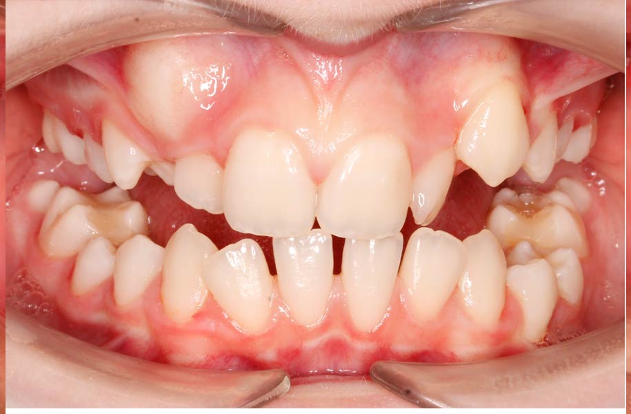 Paediatric Dentist Malaga