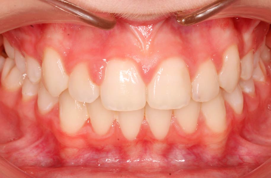 Paediatric Dentist Malaga