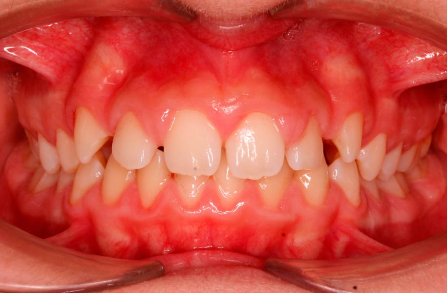 Paediatric Orthodontics Malaga