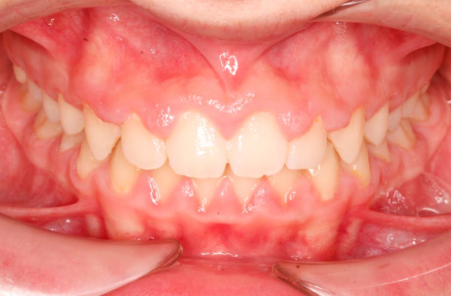 Paediatric Orthodontics Malaga