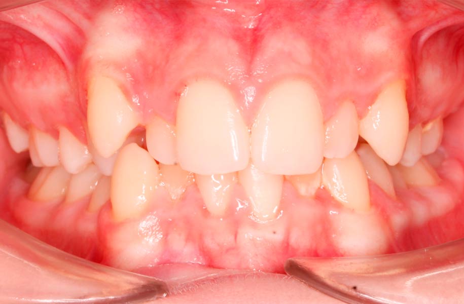 Paediatric Orthodontics Malaga