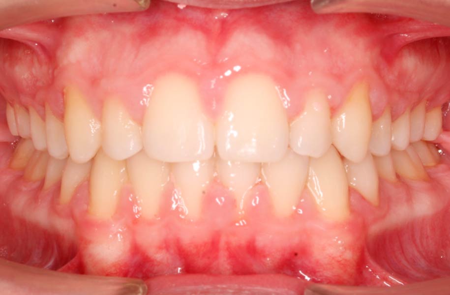Paediatric Orthodontics Malaga