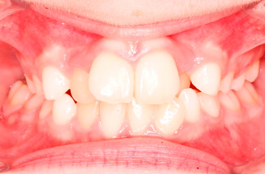 Paediatric Orthodontics Malaga