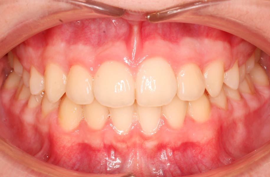 Paediatric Orthodontics Malaga
