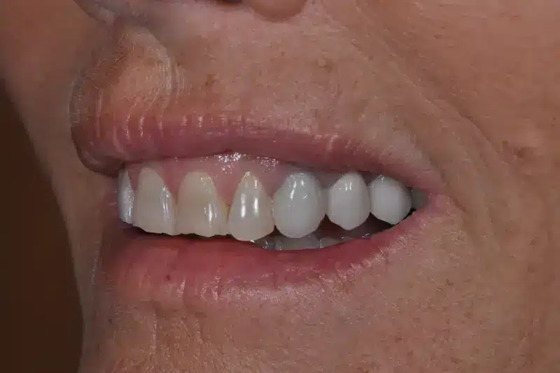 Natja
