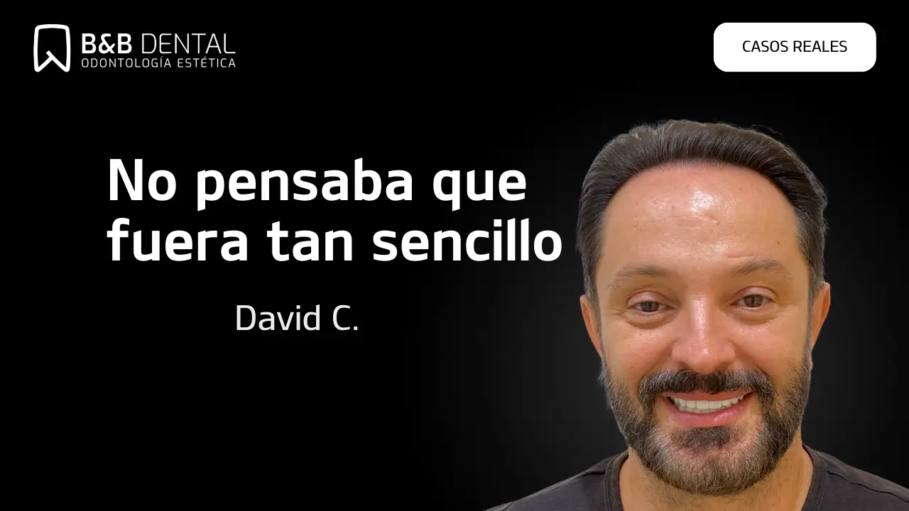 David Carrasco, caso de éxito en ByB Dental con sus implantes all on 6